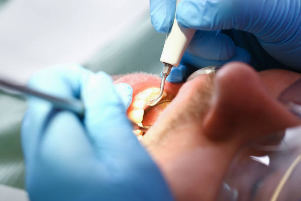 Best Emergency Treatment for Toothache in Fortville, IN